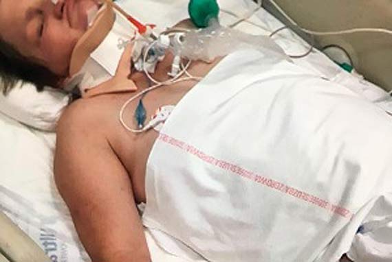 Sparali�owana rowerzystka chce wr�ci� do zdrowia