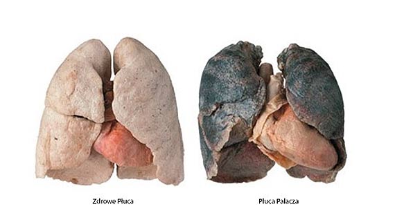 31 maja �wiatowy Dzie� bez Tytoniu