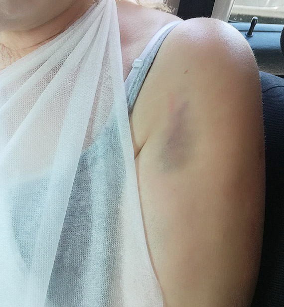 Ambulans potr�ci� kobiet� i...odjecha�. Poszukuje si� �wiadk�w zdarzenia w Kamieniu Pomorskim