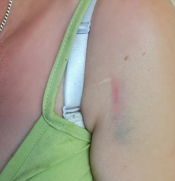 Ambulans potr�ci� kobiet� i...odjecha�. Poszukuje si� �wiadk�w zdarzenia w Kamieniu Pomorskim