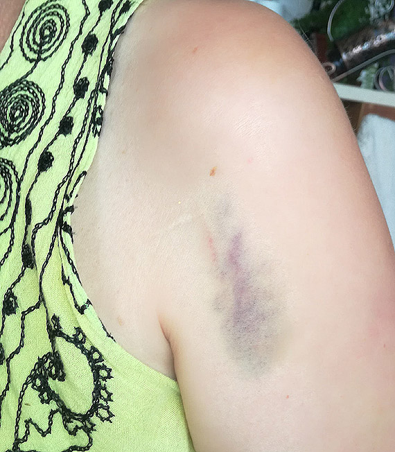 Ambulans potr�ci� kobiet� i...odjecha�. Poszukuje si� �wiadk�w zdarzenia w Kamieniu Pomorskim