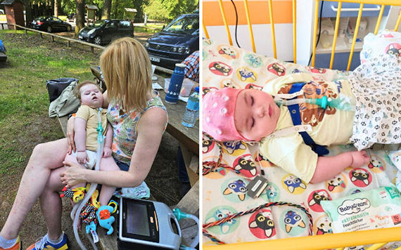 Ekstremalnie rzadki zespół Retta u chłopca! Wojtuś żyje wbrew statystykom