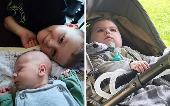 Ekstremalnie rzadki zespół Retta u chłopca! Wojtuś żyje wbrew statystykom